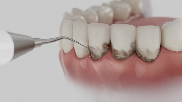 Reliable Wisdom Tooth Removal contractor in Barron County County, WI by Dentist Open Now